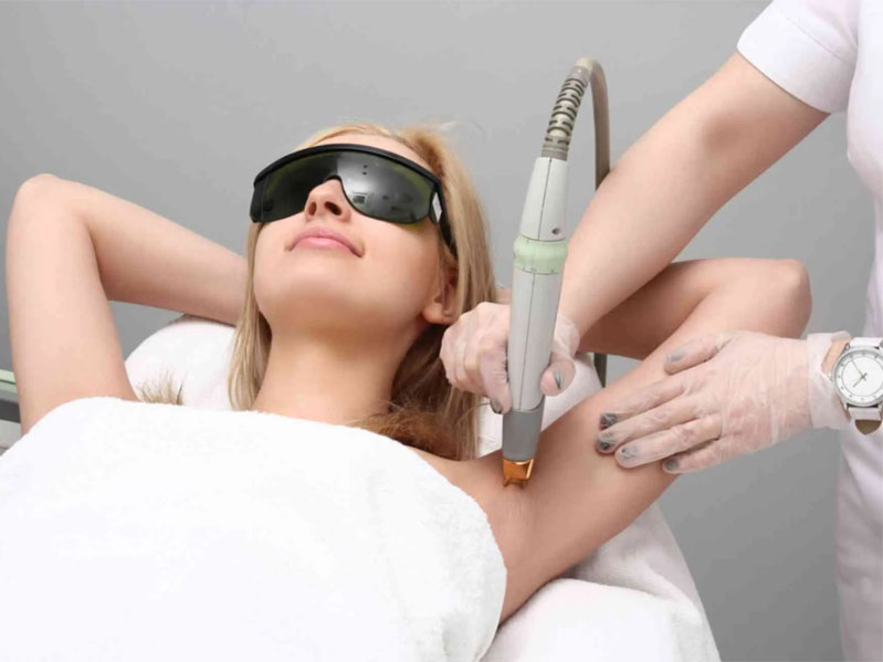 laser-hair-removal-treatment-in-kanpur