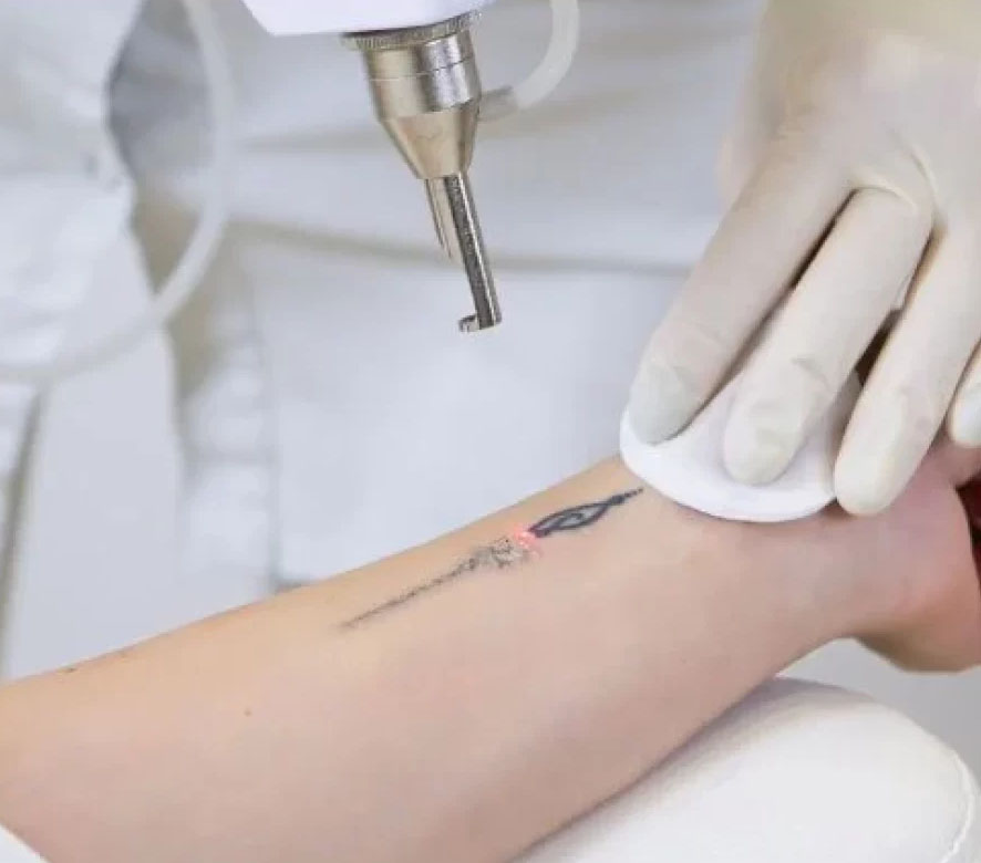 Single Tooth Implant in Kanpur